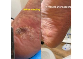 Achilles Foot Clinic