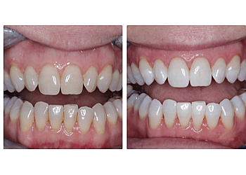 Alpha Dental Care Victoria Road