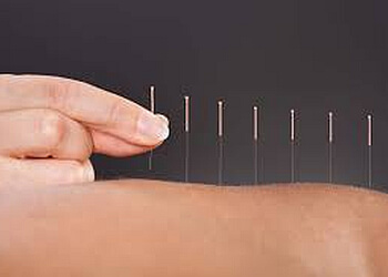 Bury Modern Acupuncture