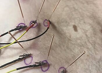 En Pointe Therapy Clinic