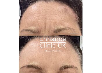 Enhance Clinic UK