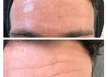 Heswall Laser Clinic