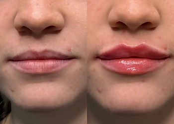 Lisa Roberts Aesthetics