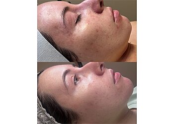 Louise Brownlie The Skin Specialist