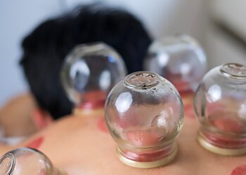 MH Acupuncture Therapies