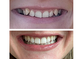 Nuvo Dental + Implant Centre