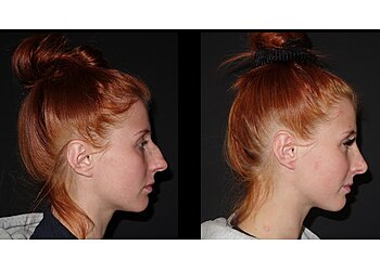 Professor Ajay Mahajan MBBS, FRCSI, M Med Sc, MD, FRCS (Plast) - AM AESTHETIC SURGERY