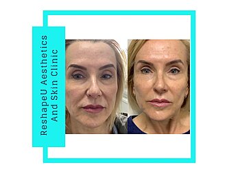 ReShapeU Aesthetics & Skin Clinic