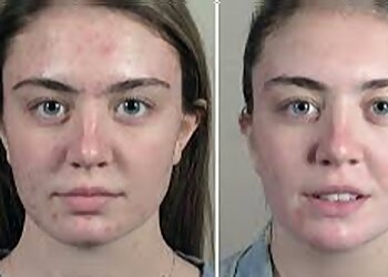 Rennaisance Health & Beauty Spa