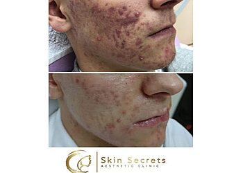 Skin Secrets Aesthetics Clinic