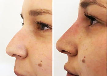 Surface Beauty Aesthetics