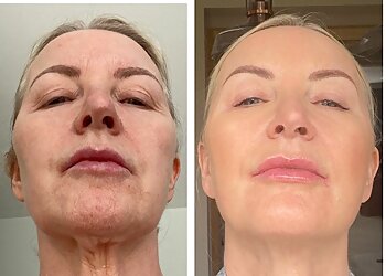 Walsall Skin Sanctuary