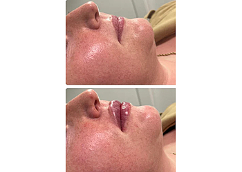 Wigtox Sculpt & Rejuvenate