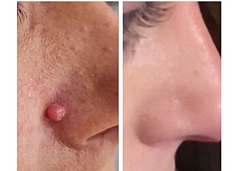 Wirral Laser Rooms, Aesthetics & Beauty